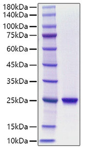Recombinant Human Chorionic somatomammotropin hormone 1/Choriomammotropin/CSH1 Protein