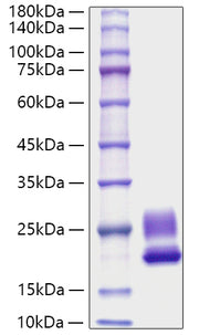 Recombinant Rat IL-21 Protein