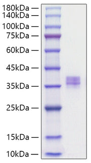 Recombinant Human MMP-7 Protein
