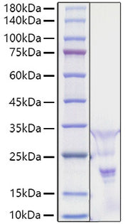 Recombinant Human PDGF-AA Protein