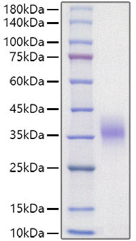 Recombinant Mouse Erythropoietin/EPO Protein