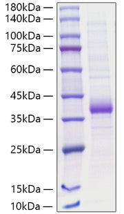 Recombinant Human Carbonic anhydrase 5A/CA5A Protein