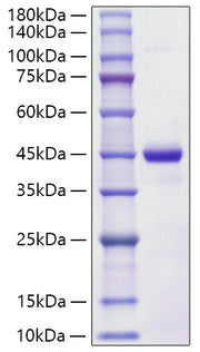 Recombinant Human S100-A7 Protein