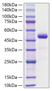 Recombinant Human Chemerin/RARRES2 Protein