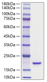 Recombinant Mouse IL-36Ra/IL-1F5 Protein
