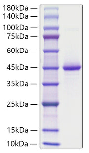 Recombinant Human Neurogranin/NRGN Protein