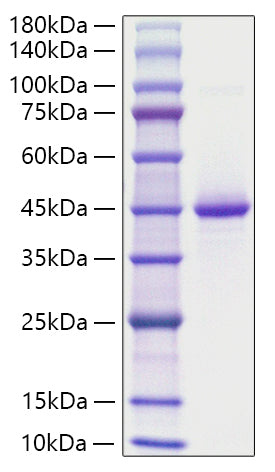 Recombinant Human Neurogranin/NRGN Protein