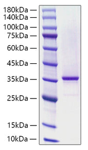 Recombinant Human KLHL20 Protein