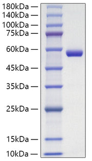 Recombinant Human Lipocalin-2/NGAL/LCN2 Protein