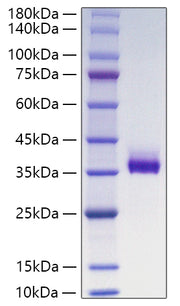 Recombinant Human Angiopoietin-like 3/ANGPTL3(237-460) Protein