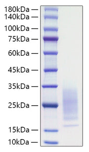 Recombinant Mouse IL-31 Protein