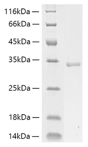 Recombinant Human Collagen I alpha 1/COL1A1 Protein