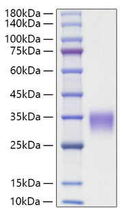 Recombinant Rat Oncostatin-M/OSM Protein