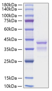 Recombinant Mouse TGF-alpha Protein