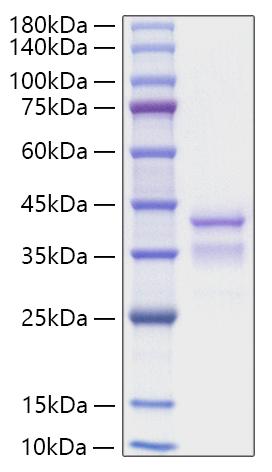 Recombinant Mouse TGF-alpha Protein