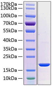 Recombinant Human PRL-2 Protein