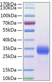 Recombinant Human Angiopoietin-like 4/ANGPTL4(166-406) Protein