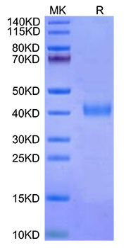 Recombinant Cynomolgus IL-2RB/CD122 Protein