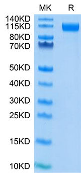 Recombinant SARS-COV-2 Spike S1(D614G) Protein