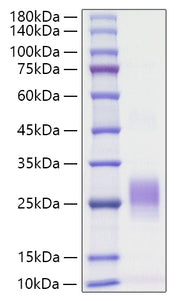 Recombinant Human TNFSF6/FAS ligand/CD178 Protein