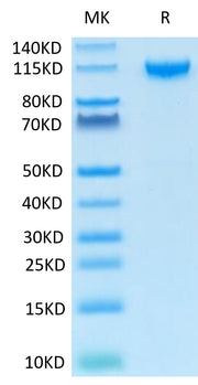 Recombinant Human IL-27RA/TCCR Protein