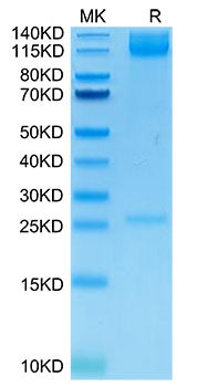 Recombinant Human Integrin alpha 5 beta 1 (ITGA5&ITGB1) Heterodimer Protein