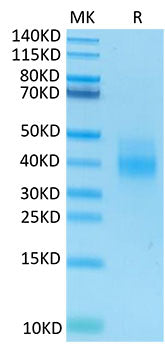 Recombinant Human NKG2A&KLRD1/CD159a&CD94 Protein
