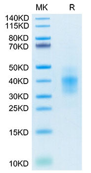Recombinant Human NKG2A&KLRD1/CD159a&CD94 Protein