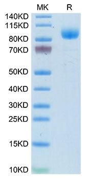 Recombinant Mouse Interferon alpha/beta receptor 1/IFNAR1 Protein
