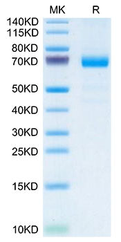Recombinant Mouse IL-20RA Protein