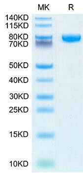 Recombinant Human IL-18 R beta/IL-1 R7/CD218b Protein