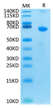 Recombinant Human TSLPR Protein
