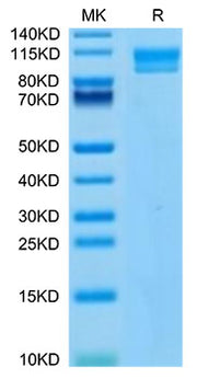Recombinant Human IL-17Rc Protein