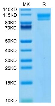 Recombinant Human IL-17Rc Protein