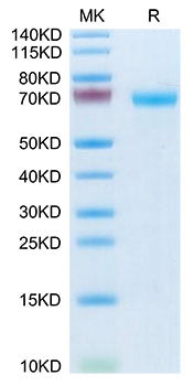 Recombinant Human MMP-8 Protein