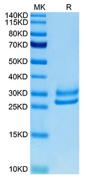 Recombinant Human IL-15RA&IL-15 Protein