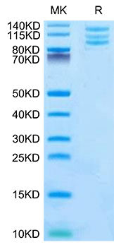 Recombinant Mouse Integrin alpha V beta 6 (ITGAV&ITGB6) Heterodimer Protein