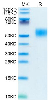 Recombinant Mouse CSF2RA/GM-CSF R alpha/CD116 Protein