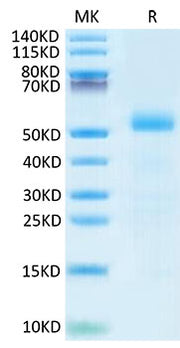 Recombinant Mouse DLL3 Protein