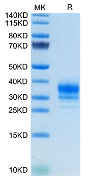 Recombinant Human FR-beta/FOLR2 Protein