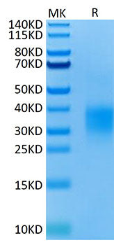 Recombinant Mouse TNFRSF18/GITR/CD357 Protein