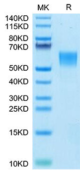 Recombinant Human ENPP-3(558-875) Protein