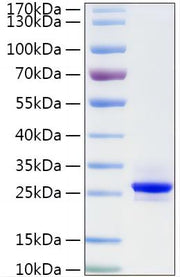 Recombinant Human CTHRC1 Protein