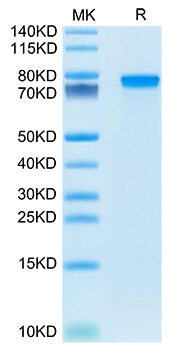 Recombinant Mouse Progranulin/PGRN/GRN Protein