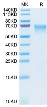 Recombinant Human MADCAM1 Protein