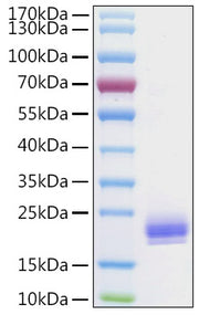 Recombinant Human Lymphotactin/XCL1 Protein