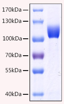 Recombinant Human MME/Neprilysin/CD10 Protein