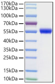 Recombinant Human NSE/ENO2 Protein