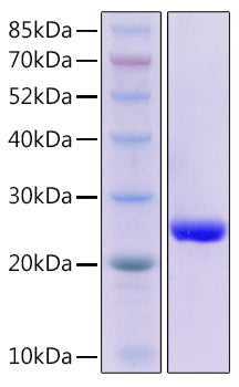 Recombinant Mouse TNFSF6/FAS ligand/CD178 Protein