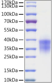 Recombinant Human Granzyme B/CTLA-1/GZMB Protein